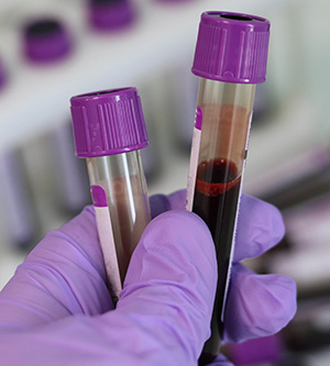 Blood Alcohol Content